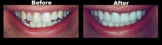Case_1